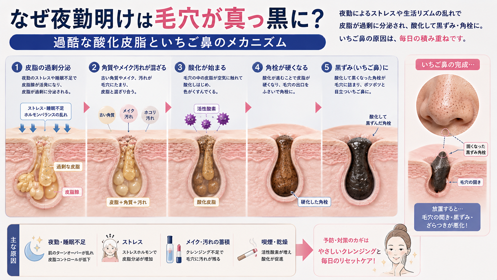 夜勤による皮脂の過剰分泌と角質・メイク汚れが混ざり、酸化して黒ずみ角栓やいちご鼻になるメカニズムを解説した図
