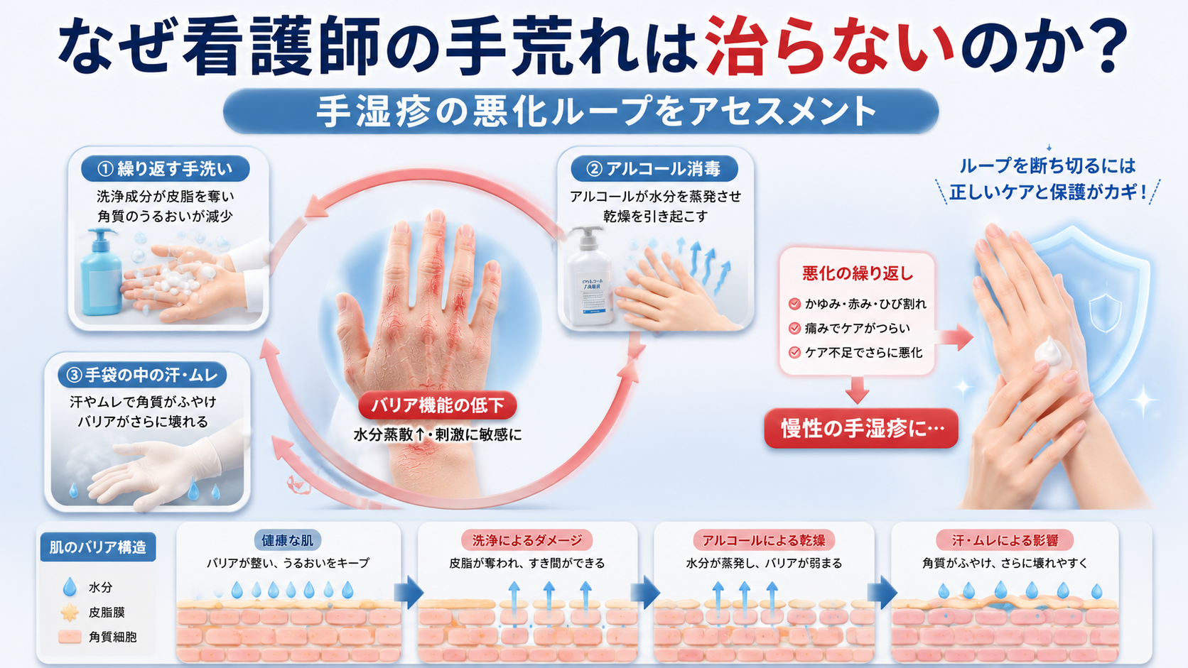 看護師の手荒れが治らない原因となる手洗い・アルコール消毒・手袋内の汗による皮膚バリア機能低下と手湿疹の悪化ループを解説した図