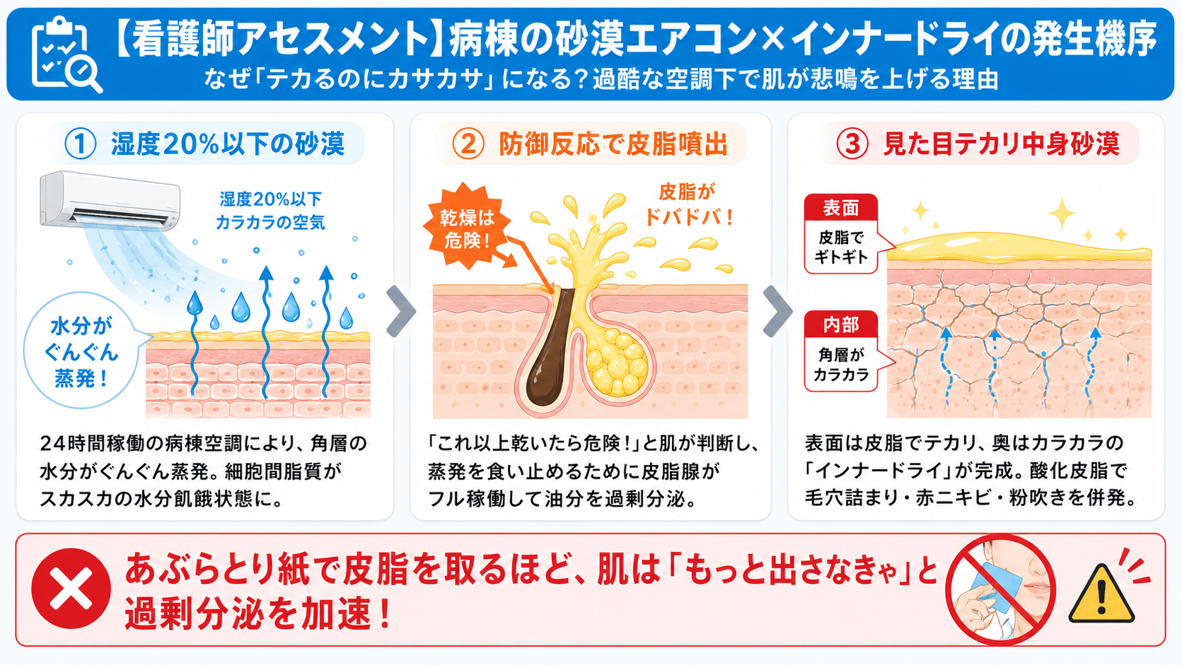 病棟のエアコンによる乾燥で、角層の水分蒸発・皮脂の過剰分泌・インナードライが起こる流れを3ステップで解説した看護師向け図解
